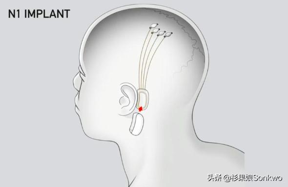 马斯克的龙飞船与俄罗斯的联盟号,马斯克龙飞船给火箭行业的启示