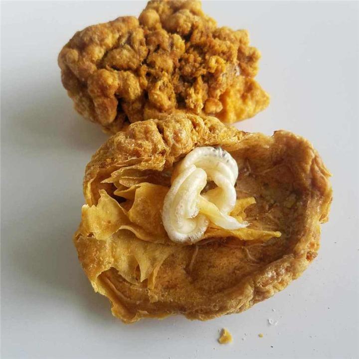 生完孩子后胎盘是怎么处理的,生完孩子后胎盘一般怎么处理