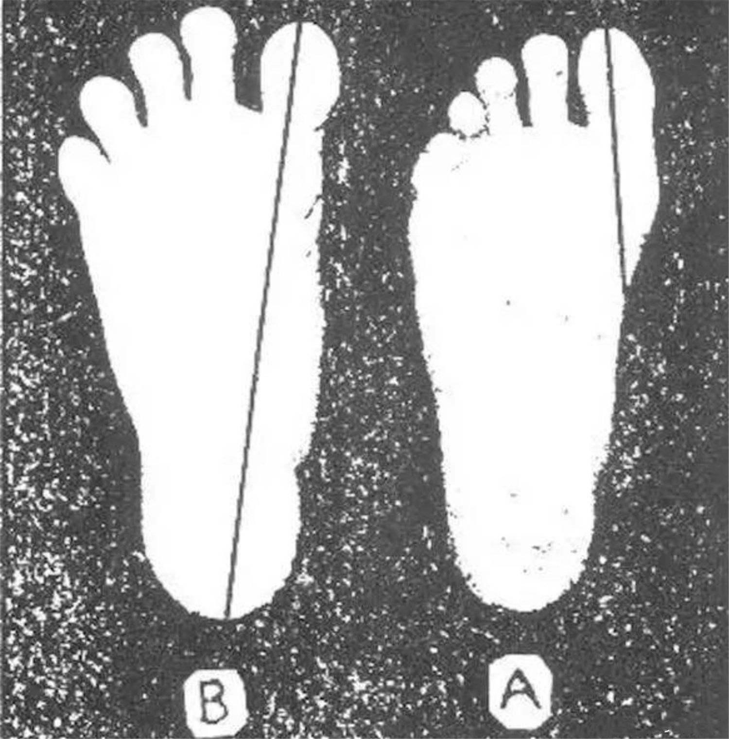 孩子死活不爱穿袜子怎么办,孩子不乐意穿袜子