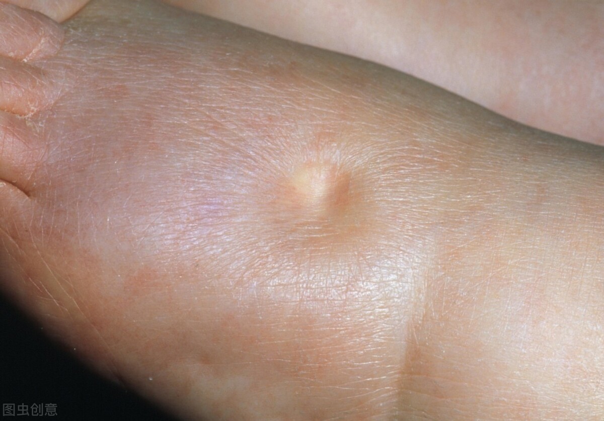 出现这八大症状警惕心血管病,出现这几种症状说明心脏病严重