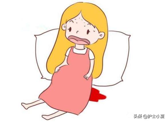 一个月内药物流产的个人感受,药物流产的详细说明