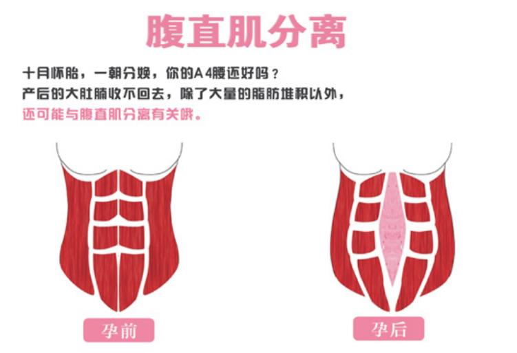 产后肚皮像橘子皮一样,产后肚子圆圆的像个球