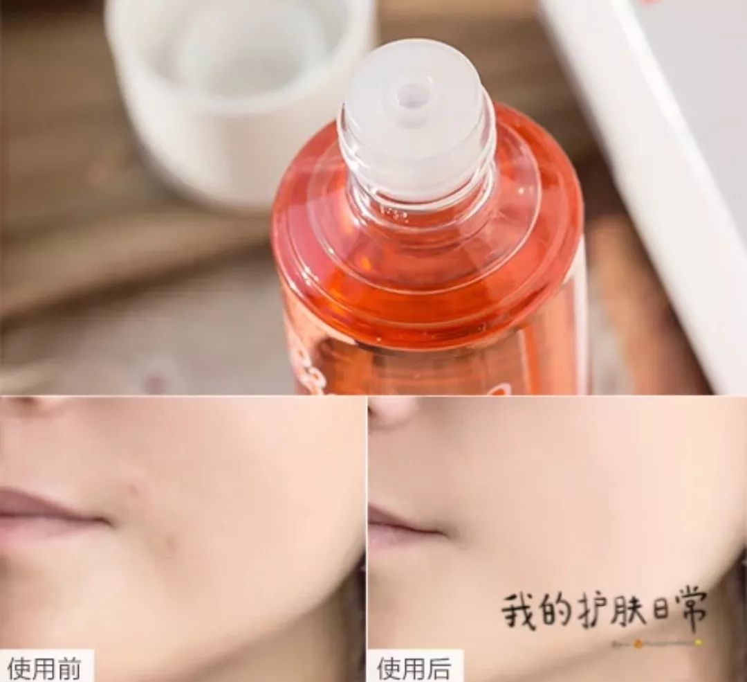 618囤什么护肤品最好,618必买清单排行榜囤货