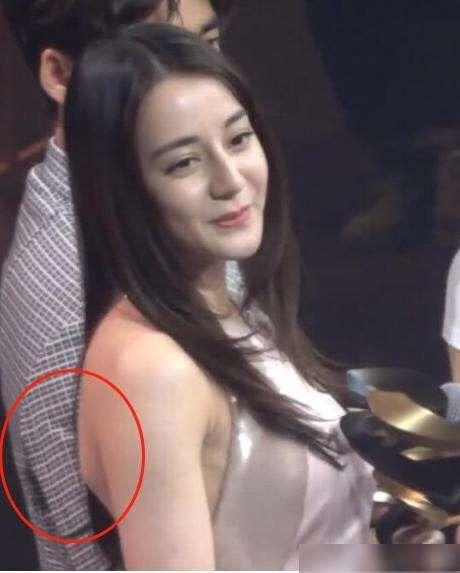 改善蝴蝶背的方法,天生的蝴蝶背能改善吗