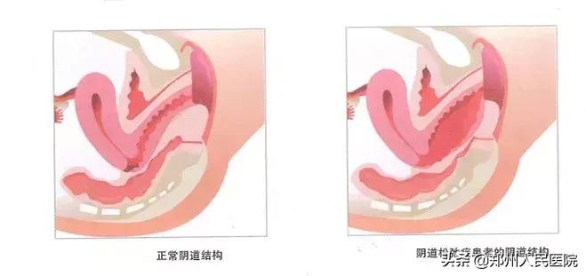 女性的难言之隐有哪些,女人的难言之隐只有女人才知道