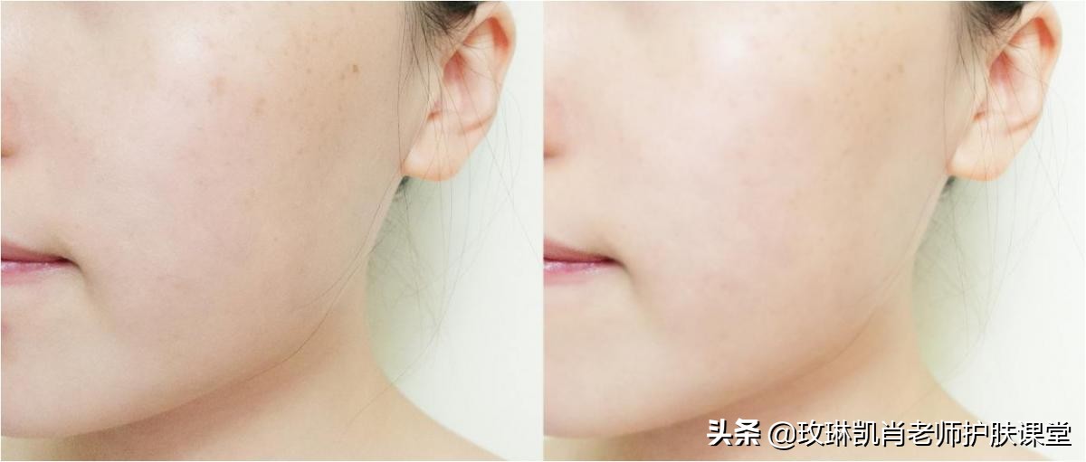 护肤步骤最后一步，敷面膜！教你选择适合自己肤质的面膜！