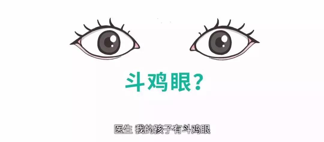 教你一招辨别宝宝真假斗鸡眼,怎么辨别自己眼睛不是斗鸡眼