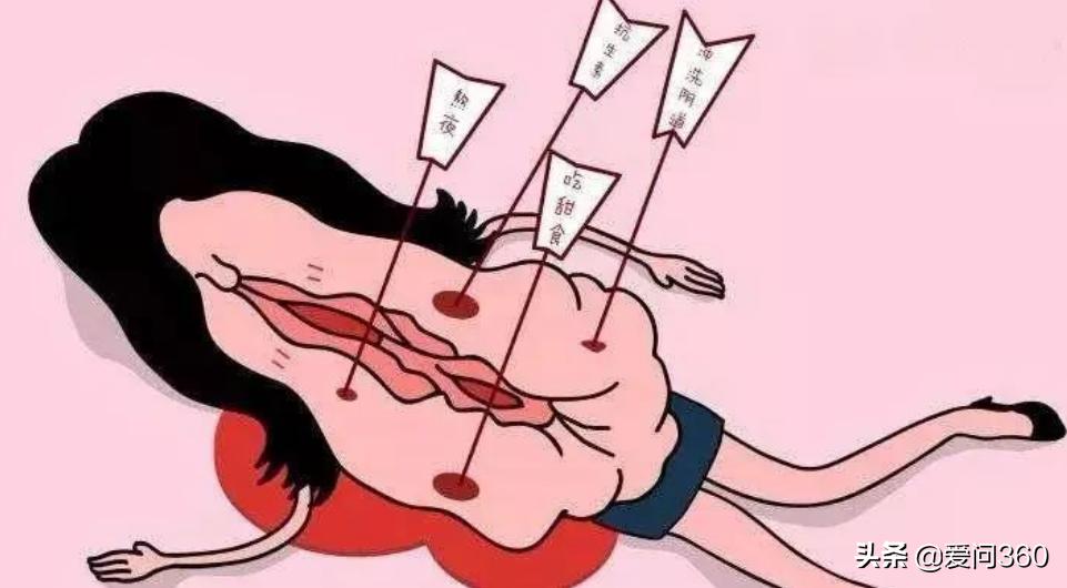 阴道炎的常见症状该怎么治疗,阴道炎症状怎么预防