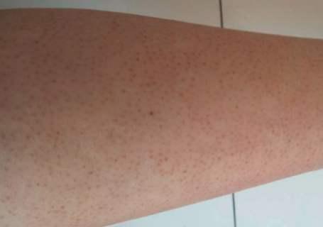 擦身体乳可以细腻皮肤么,经常擦身体乳能美白吗