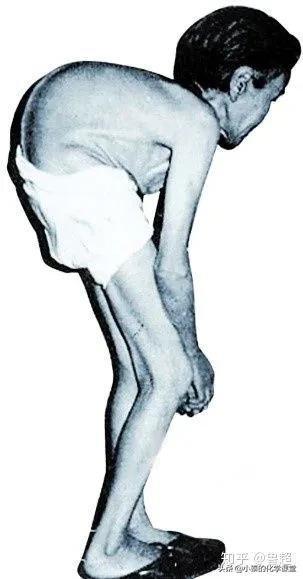 十大危险化学元素,哪些化学元素对人体有害