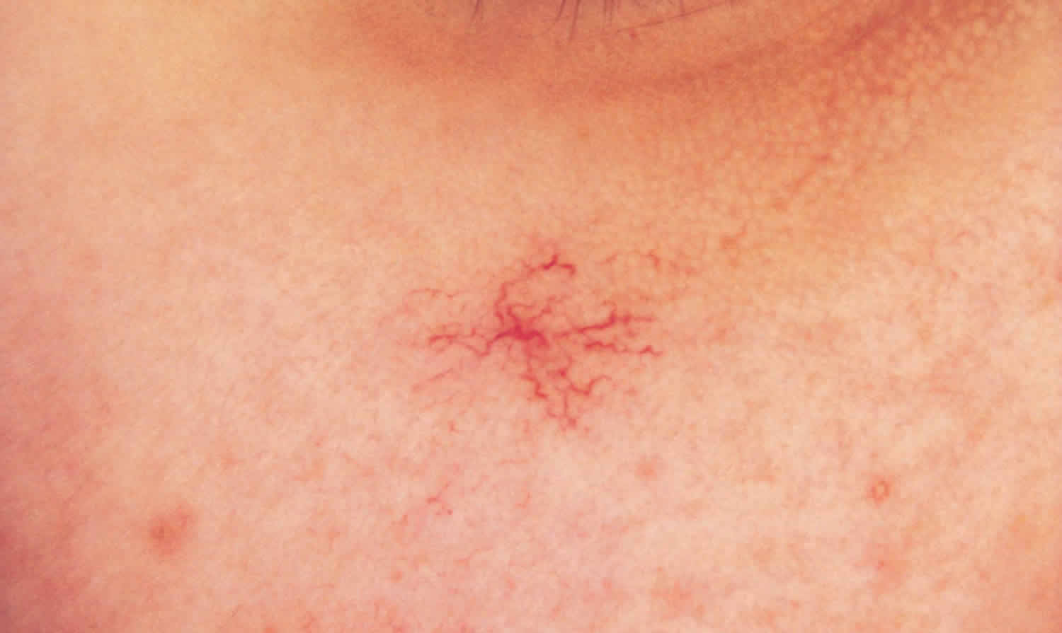 身上出现很多小红点,是不是身体出了问题?