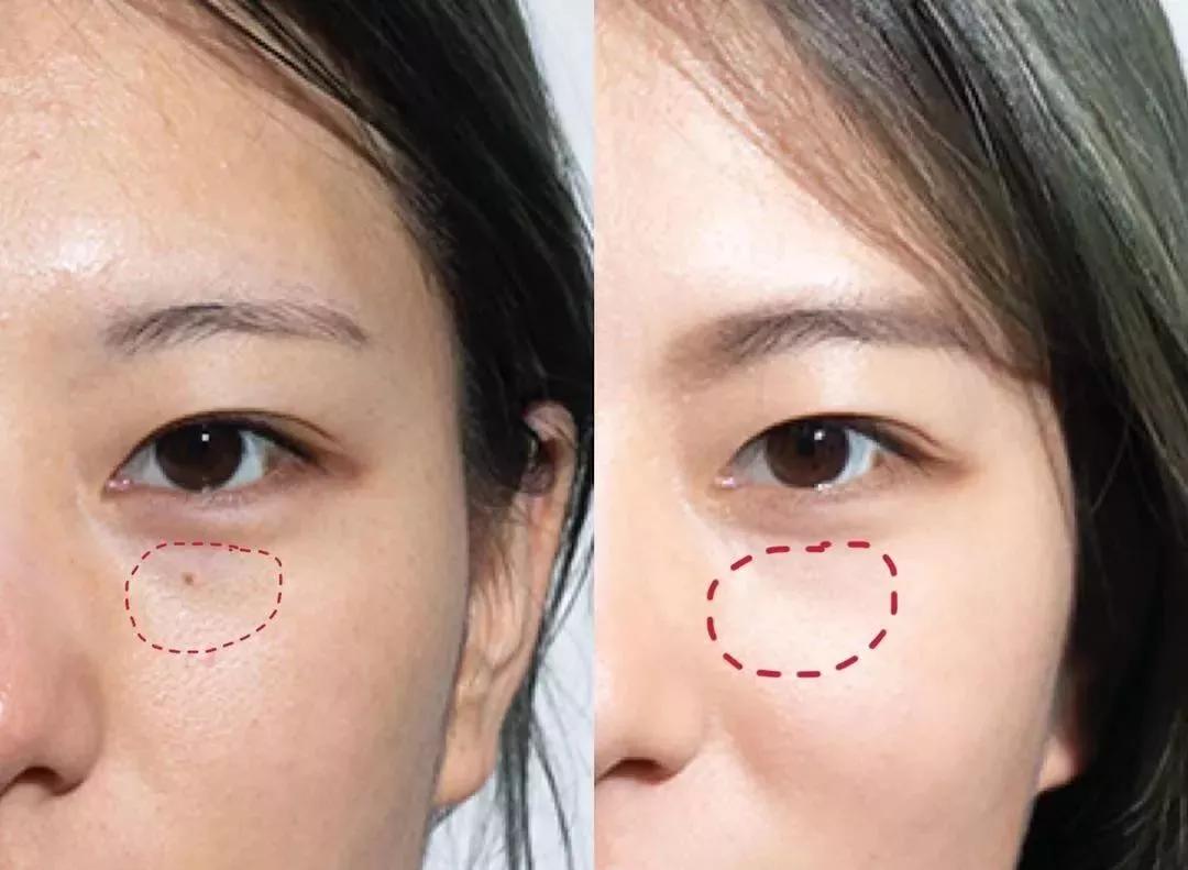 毛戈平遮瑕手法李佳琦 (李佳琦毛戈平推荐)