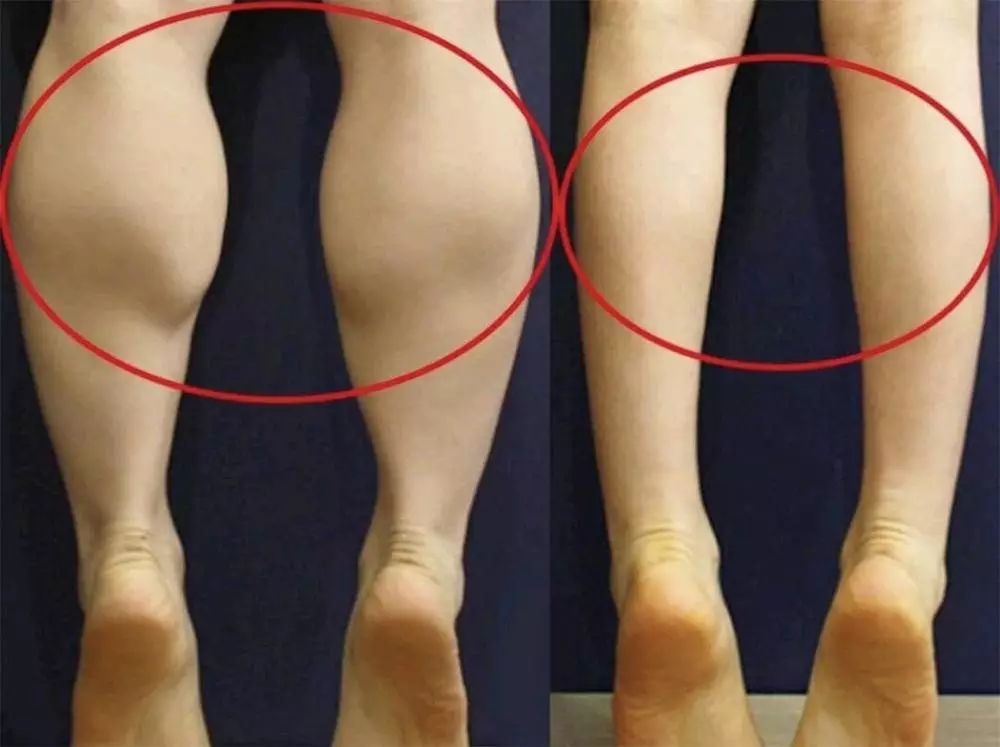 郑爽同款漫画腿不动刀也能get？吴昕的萝卜腿有救了