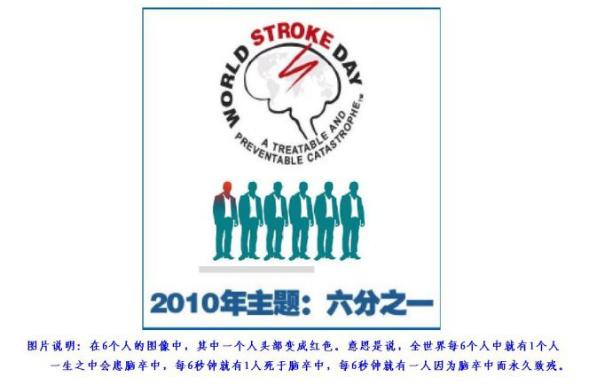 体外反搏治疗心梗,脑梗死做体外反搏