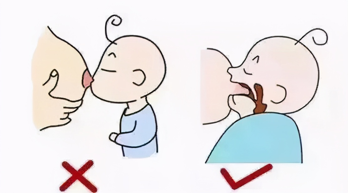 哺乳期乳头经常白泡怎么回事,哺乳期白点和白泡区别