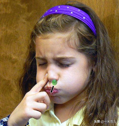 5岁鼻异物,18岁仍作妖!儿童发生鼻腔异物,先来做好这4步