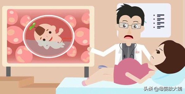 孕期产检:B超,唐筛,羊水穿刺,彩超...什么时间最合适?注意