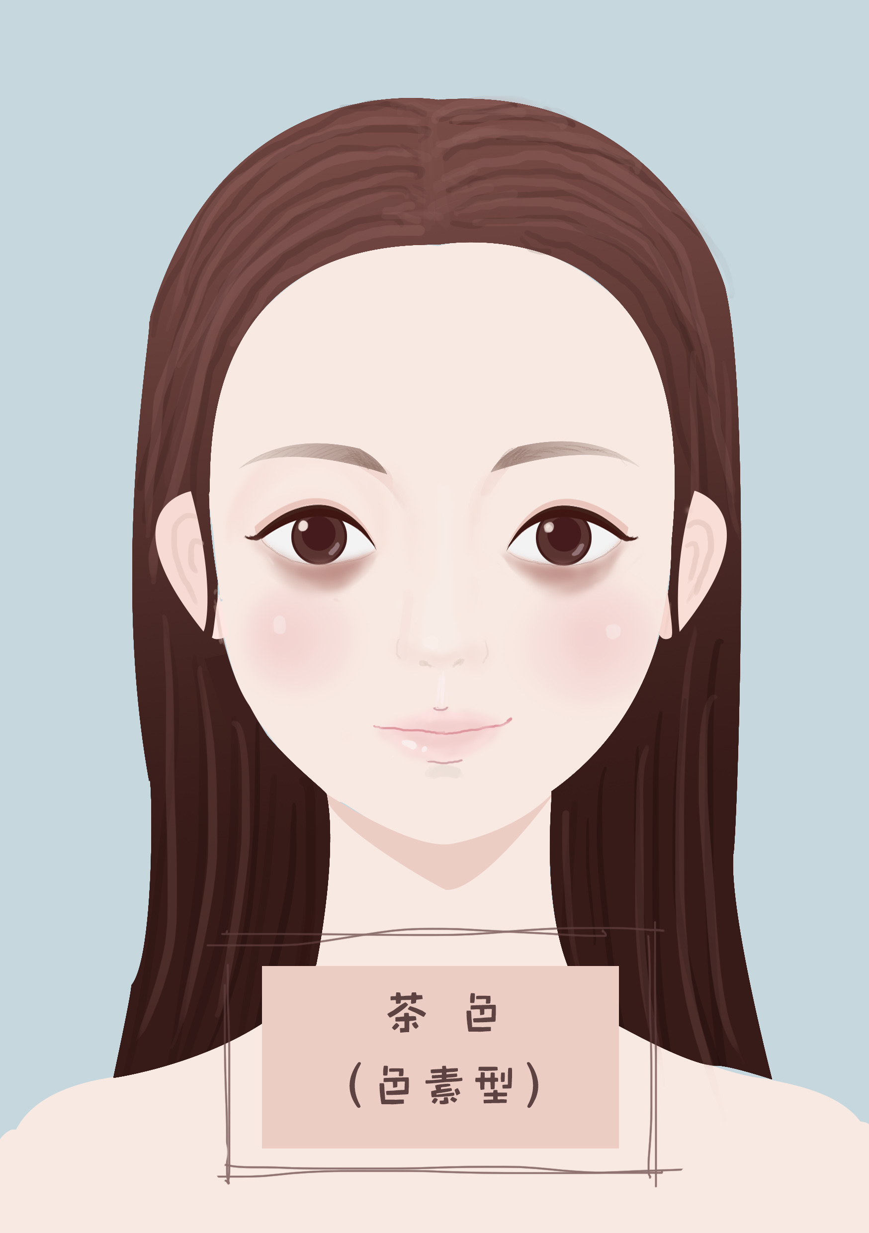 顽固性黑眼圈是什么原因,严重的黑眼圈怎么解决