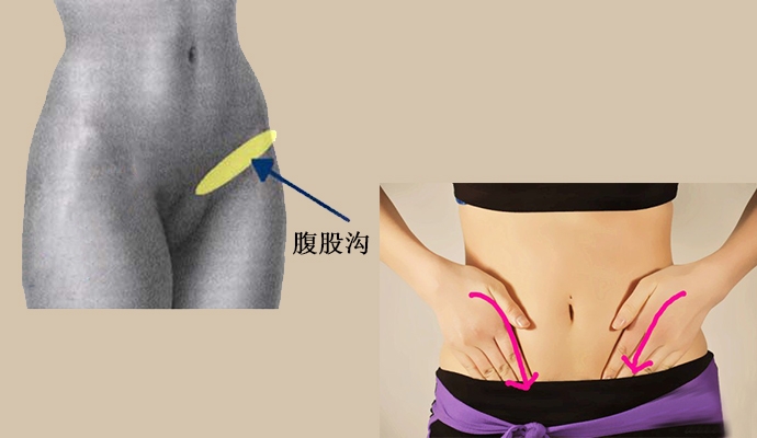 大腿根部摸到一个小包块，居然是癌症晚期，这个病例值得我们深思