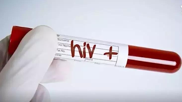 美国艾滋病疫苗最新准确消息,猴子实验艾滋疫苗