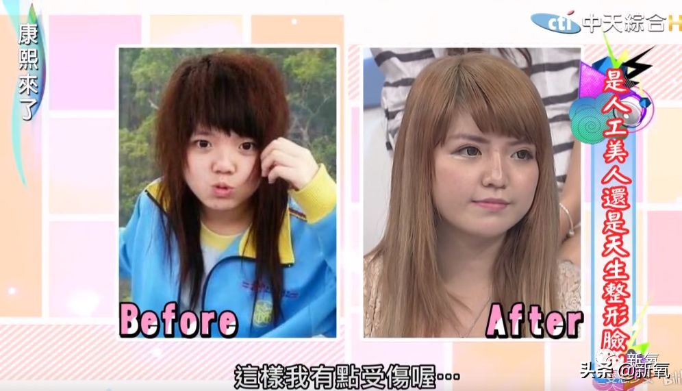 花90万从头整到脚，还可以这么自然？旁边纯天然小姐姐都看懵了