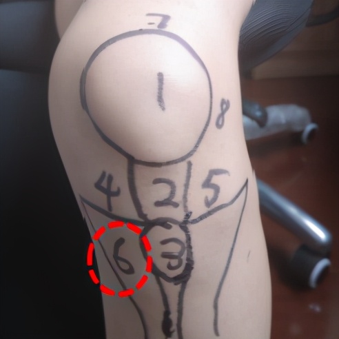 不同膝盖疼痛是暗示什么,不同位置的膝盖疼