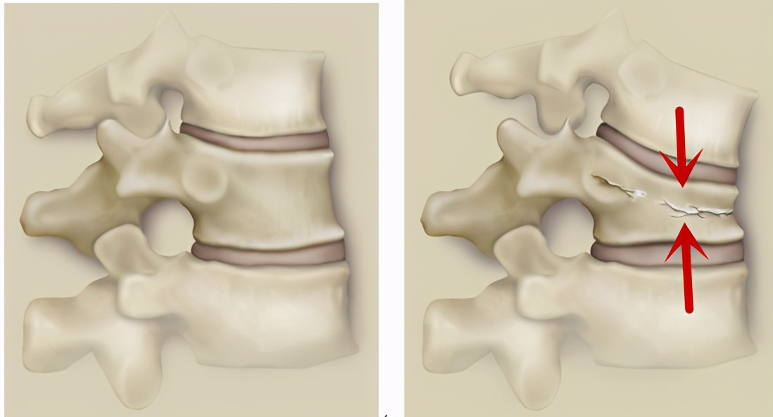 翻身疼深呼吸疼是怎么回事,向左翻身疼是怎么回事