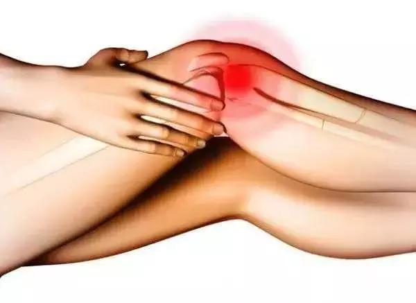 专家解答骨关节炎6大常见问题,解决膝关节炎必须要知道的4件事