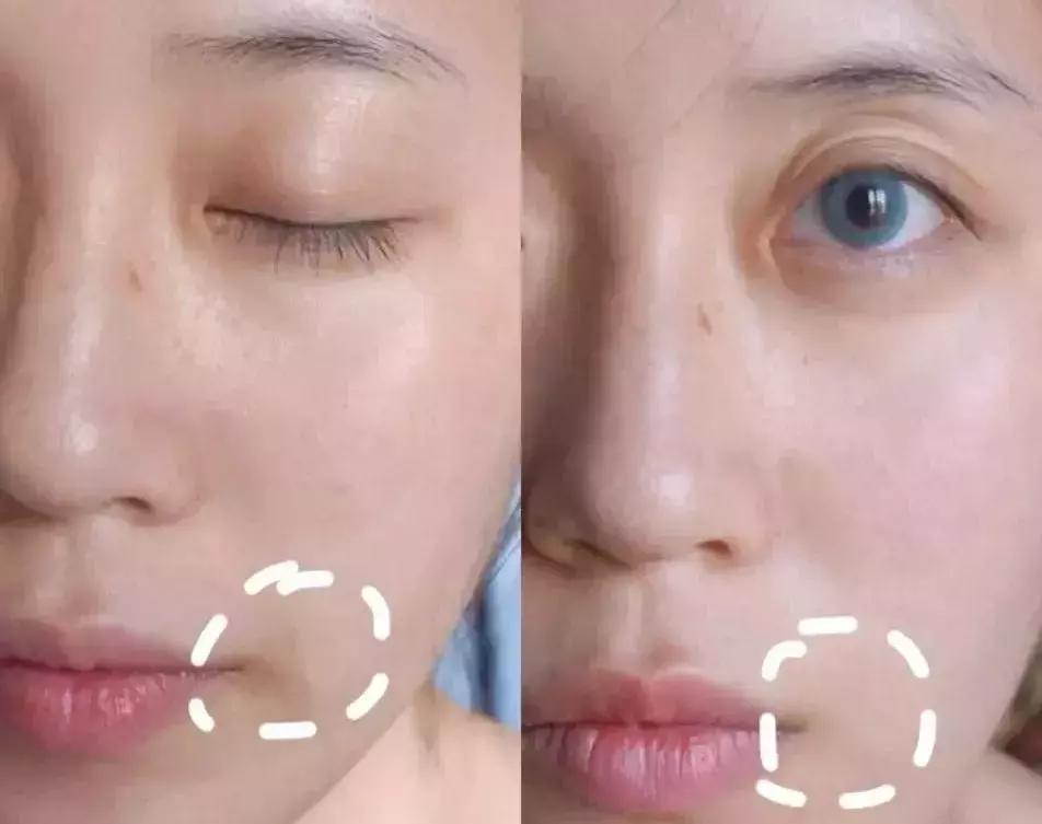 年轻人的抗老精华,用了惊艳的抗老精华