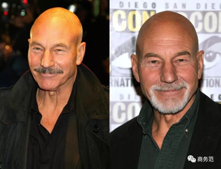 威廉王子秃顶了哈里为啥没秃顶,威廉王子为什么喜欢秃顶