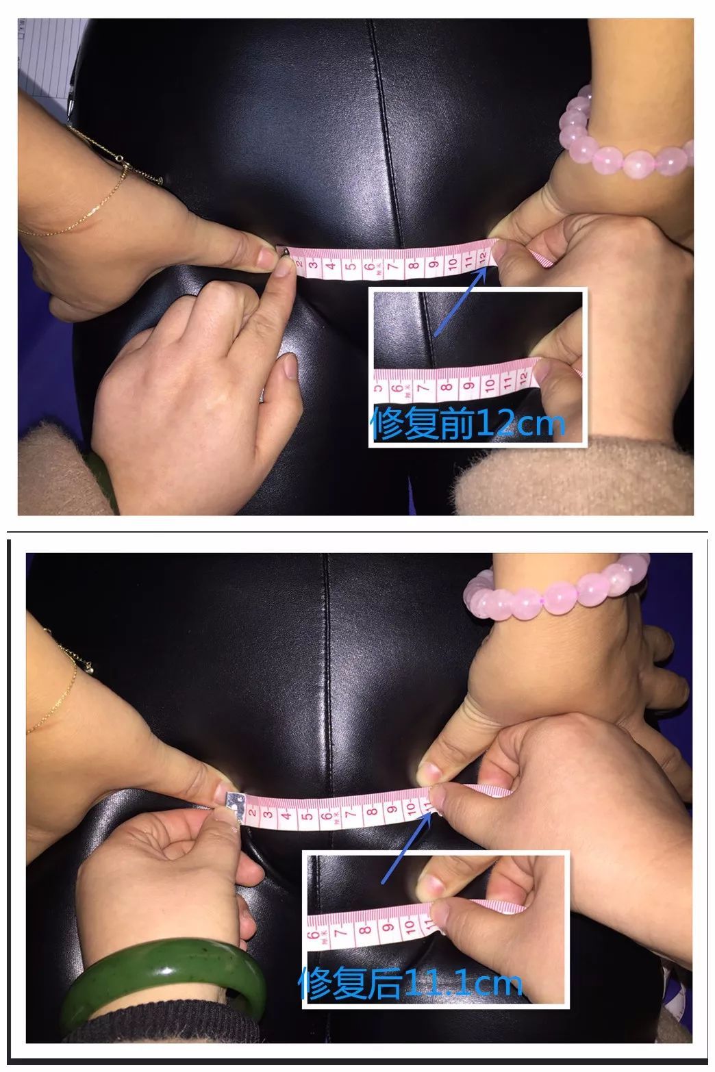 产后盘腿坐不利于骨盆恢复吗,产后六个月骨盆还可以恢复吗