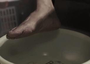 手脚干裂倒刺怎么治疗,手脚经常脱皮开裂最佳治疗方法