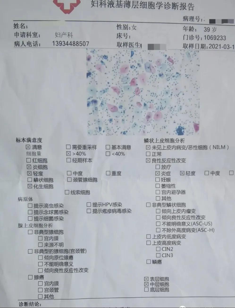 宫颈癌前病变科普视频,宫颈癌癌前病变离宫颈癌还有多远