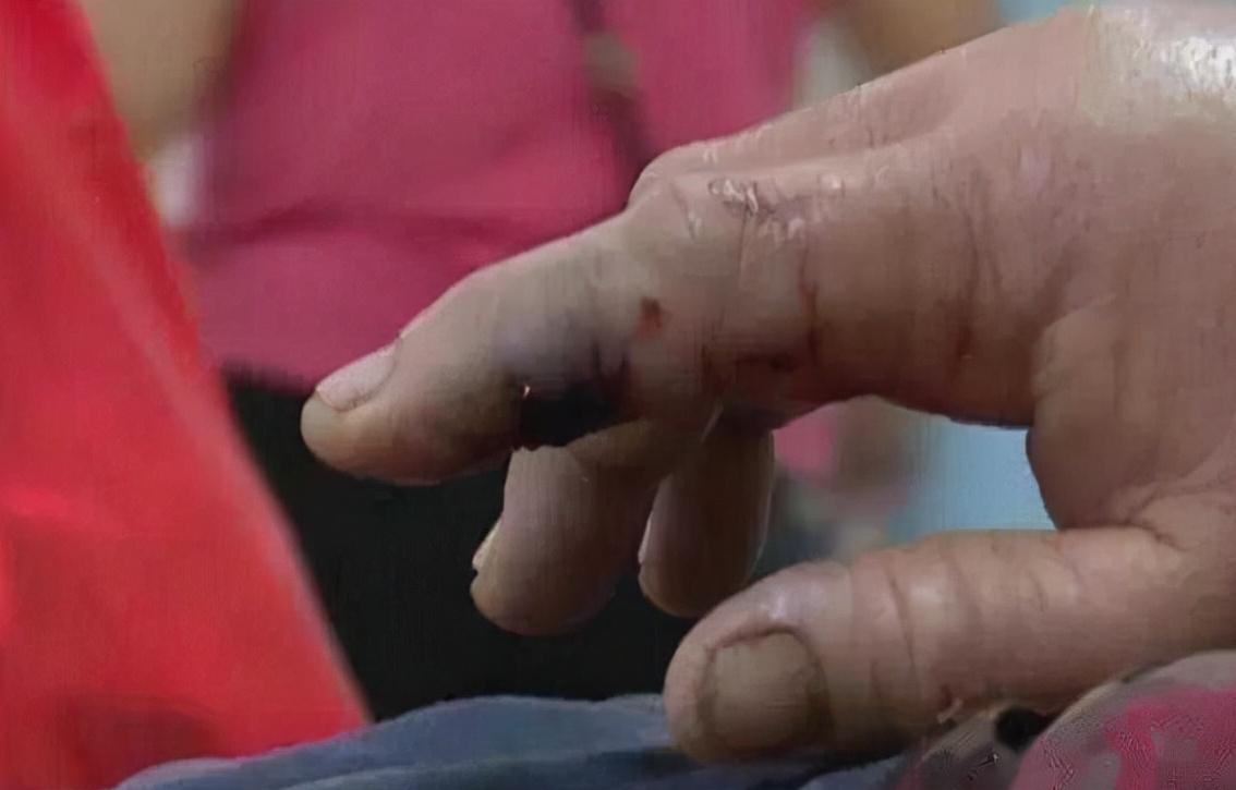 柴房惊现“烂草蛇”！广东66岁老人被咬伤！这是什么蛇？有多毒？