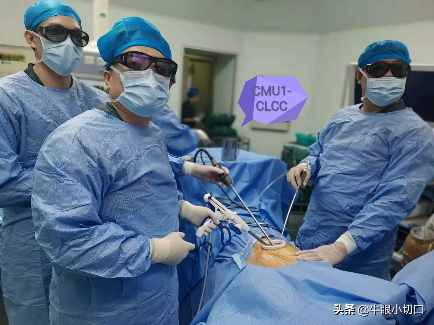 磨玻璃影肺腺癌切除最佳时机,肺磨玻璃结节ggo和ggn各表示什么