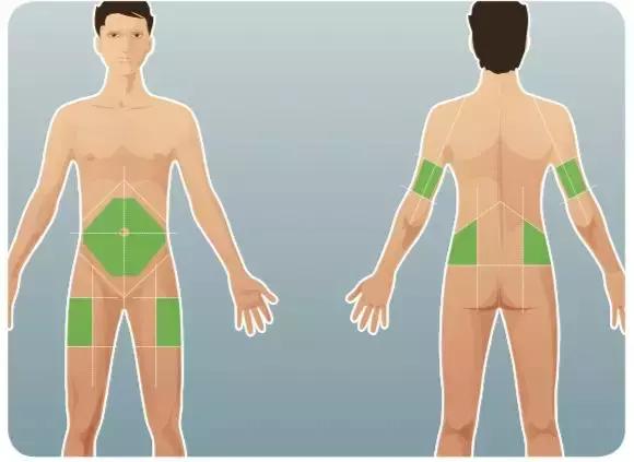 胰岛素打的疼不疼,胰岛素打起来痛