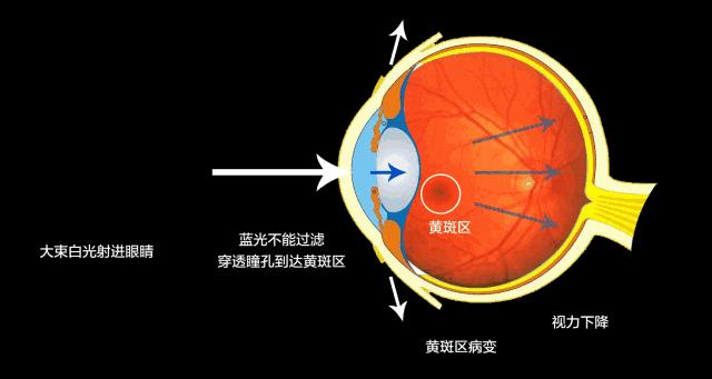 暑假来临别忘了给孩子检查视力,暑假来了怎样让孩子远离近视