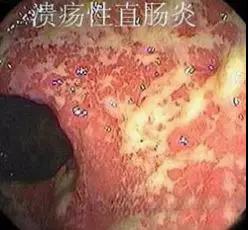 狭窄空间处理,狭窄的窗口怎么处理