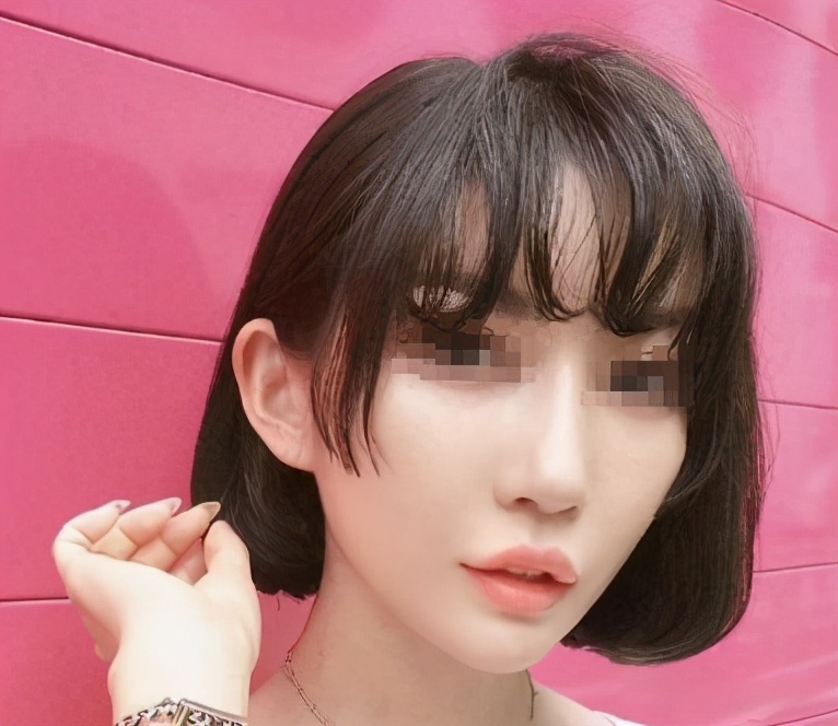 成功的鼻子以后要修复吗,隆鼻修复四次成畸形鼻