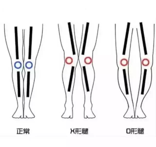 筷子腿好看还是有点肉的腿好看,怎么拥有好看的筷子腿
