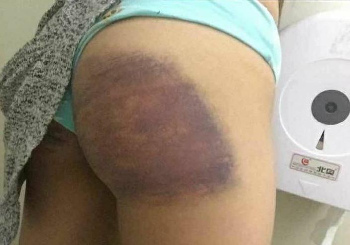 离开豫章书院三年仍做噩梦：关小黑屋、打龙鞭、罚跪孔子像，揭露者遭剁手威胁，吞6种感冒药自杀