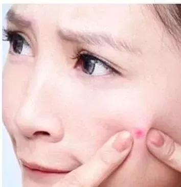 挤痘进入icu,随手挤了个痘痘