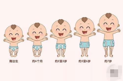 小孩是o型腿图片,孩子x型腿很严重应该怎么解决