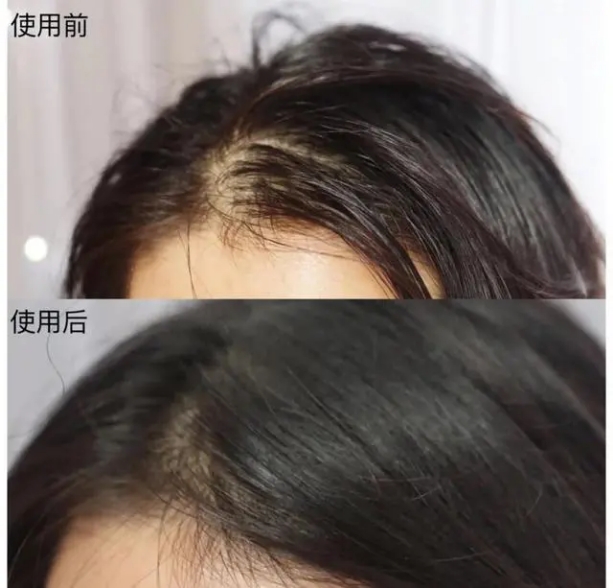 国货洗发水推荐控油蓬松海飞丝,海飞丝洗发水与飘柔洗发水的区别