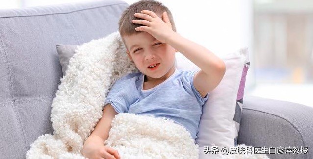 银屑病瘙痒的病理生理过程,敏感肌肤和系统性红斑狼疮