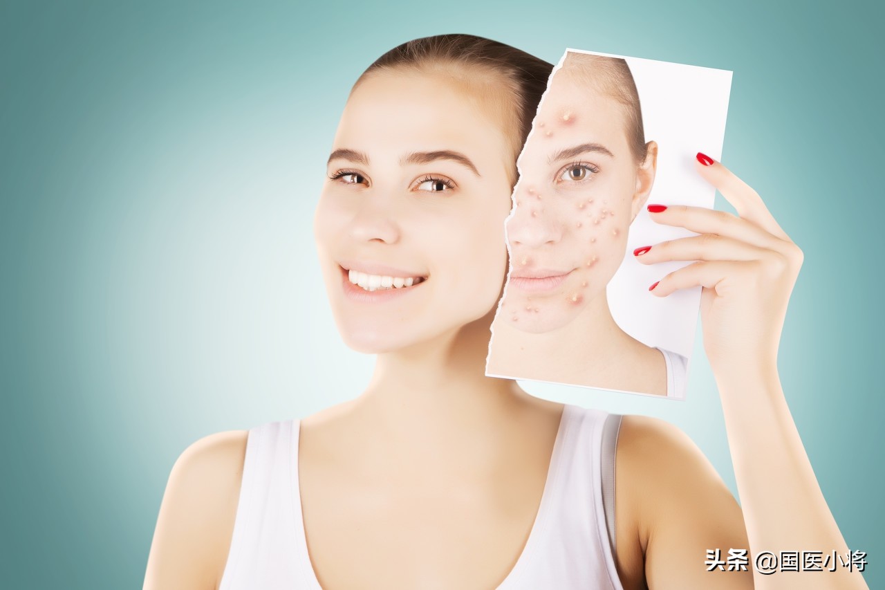 疮怎么快速消除,长疮留下的疤痕怎么修复