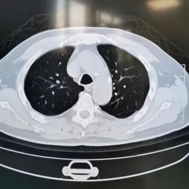 阵发性房颤和用药有关系吗,房颤药物控制好了还会复发吗