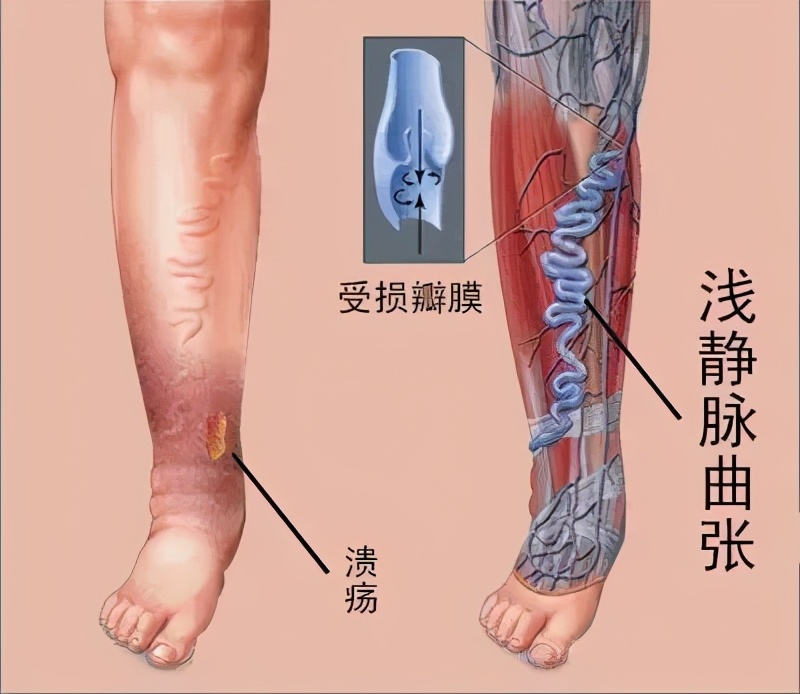 西安红会医院心血管住院部,西安市红会医院心血管内科地址