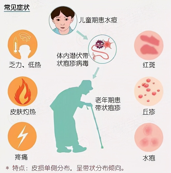 带状疱疹为什么痛不欲生,让人疼痛难忍的带状疱疹