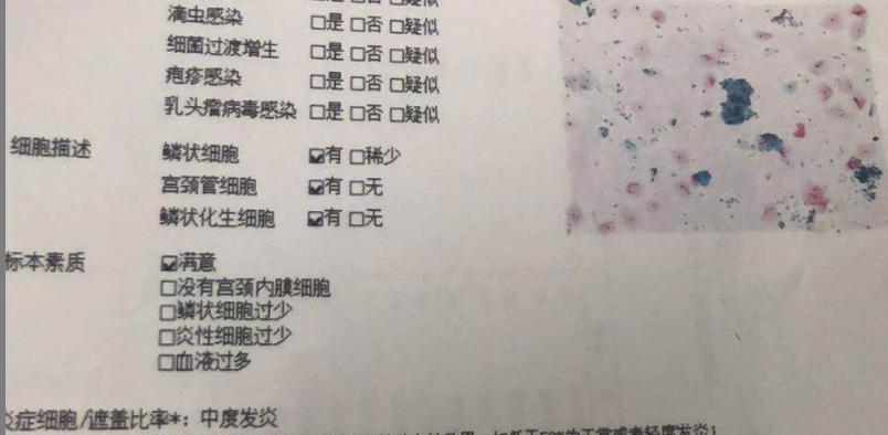 HPV转阴记丨全国肿瘤防治宣传周